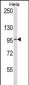 BCL6 Antibody (C-term)