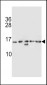 HIST1H2AB Antibody (N-term)