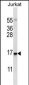 DDIT3 Antibody (Center)