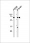 LZTS1 Antibody (N-term)