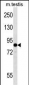 EIF2B5 Antibody (N-term)