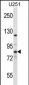 EIF2B5 Antibody (N-term)