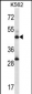 ADSS Antibody (C-term)