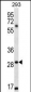 MESP1 Antibody (N-term)