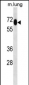 MEPCE Antibody (Center)