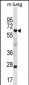 SP2 Antibody (C-term)