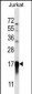 PFDN5 Antibody (Center)