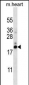 PFDN5 Antibody (Center)