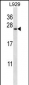 COPZ1 Antibody (N-term)