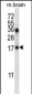 COPZ1 Antibody (N-term)