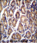 RARRES1 Antibody (C-term)