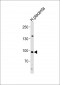 NFATC4 Antibody (C-term)