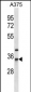 NAT1 Antibody (center)