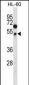 FOXA2 Antibody (Center T156)