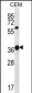 WNT16 Antibody (C-term)