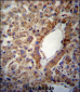 ACSS2 Antibody (Center)