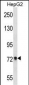 ACSS2 Antibody (Center)