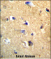 CDH22 Antibody (Center)