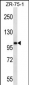 AR Antibody (Center)