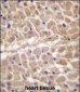 TRIM11 Antibody (C-term)