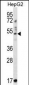 TRIM11 Antibody (C-term)