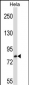 TRIM37 Antibody (C-term)