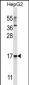 TRIM48 Antibody (N-term)