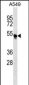TRIM54 Antibody (N-term)