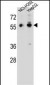TRIM64 Antibody (C-term)