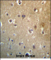 HDAC3 Antibody (C-term)