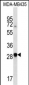 CXCR6 Antibody (N-term)