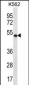 APOBEC3G Antibody (C-term)