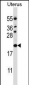 CDKN1B Antibody (C-term)