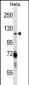 PARP1 Antibody (N-term)