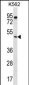 PTEN Antibody (C-term)