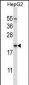 NDUFAF2 Antibody (Center)