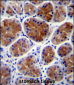TFCP2L1 Antibody (Center)