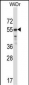 TFCP2L1 Antibody (Center)