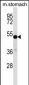 TFCP2L1 Antibody (Center)