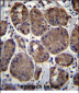 CLEC7A Antibody (N-term)