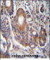 RAB21 Antibody (C-term)