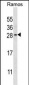 RAB21 Antibody (C-term)