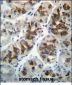 CTGF Antibody (Center)