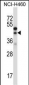 CTGF Antibody (Center)