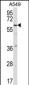 TFCP2L1 Antibody (C-term)