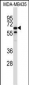 TRIM39 Antibody (Center)