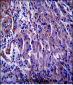 CDKN1A Antibody (C-term)