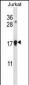 CDKN1A Antibody (C-term)