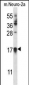 CDKN1A Antibody (C-term)