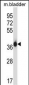 EIF2S1 Antibody (N-term)